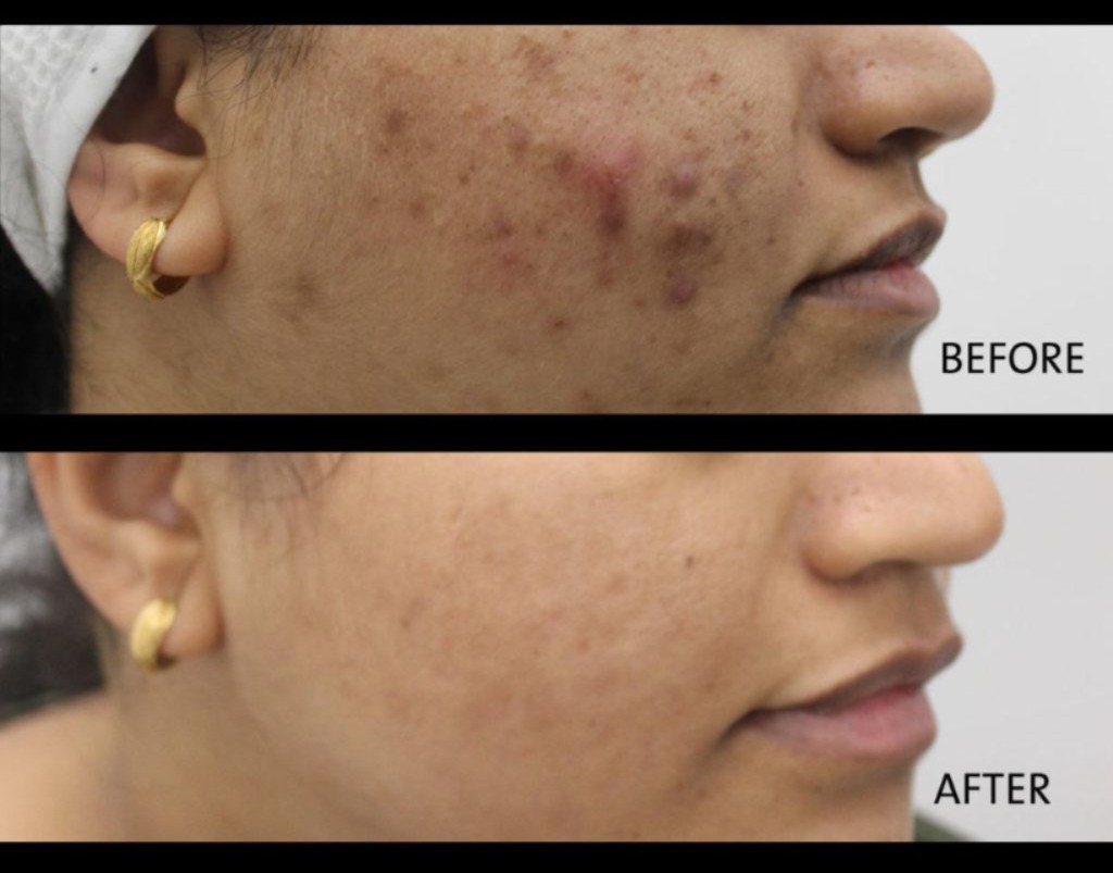 best skin dr. in narmadapuram.